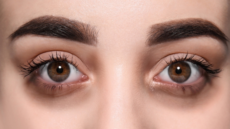 Prikaz očiju sa vidljivim podočnjacima i blagim otokom ispod očiju