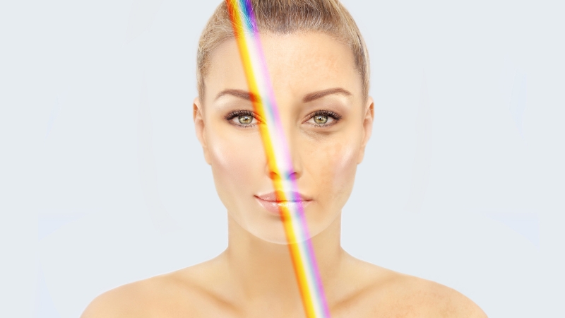 Žena sa jasno podeljenim licem gde jedan deo pokazuje uticaj sunčevog zračenja na kožu